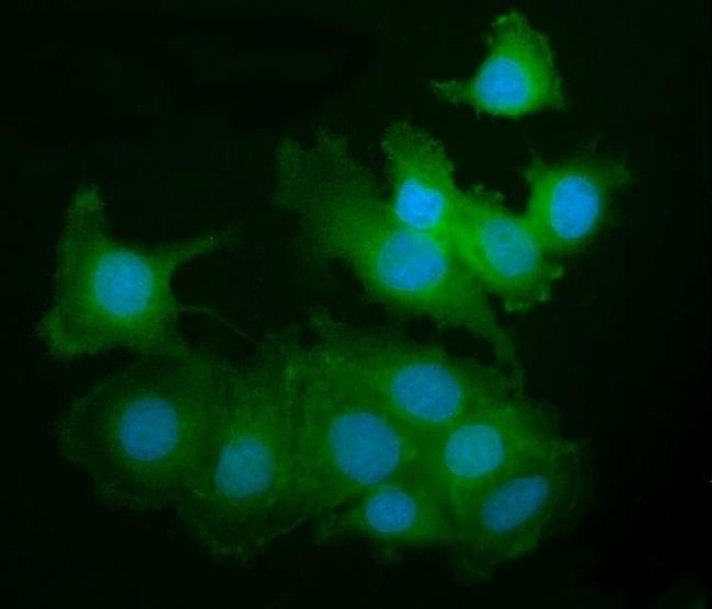 PAK2 Antibody in Immunocytochemistry (ICC/IF)