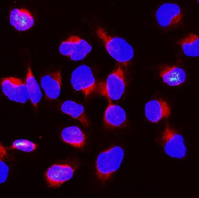 BUBR1 Antibody in Immunocytochemistry (ICC/IF)