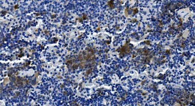 TIGIT Antibody in Immunohistochemistry (Paraffin) (IHC (P))