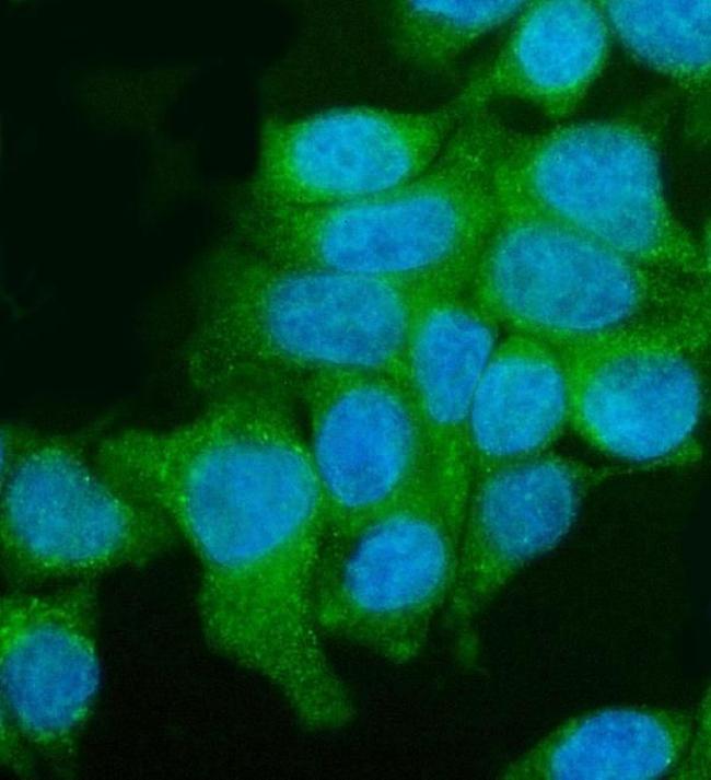 UTRN Antibody in Immunocytochemistry (ICC/IF)