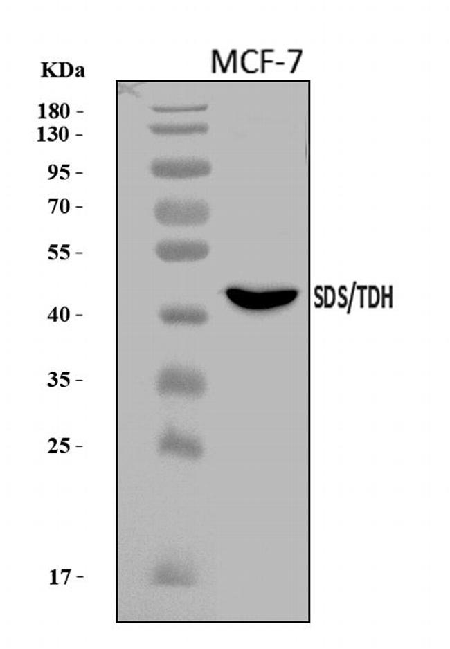 SDS Antibody in Western Blot (WB)