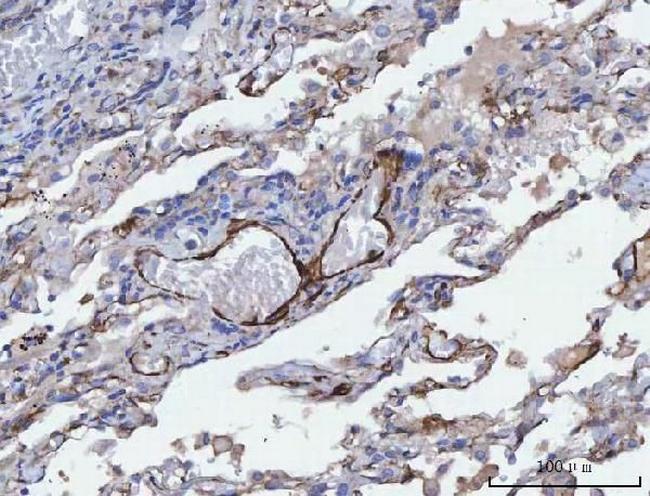 TPM2 Antibody in Immunohistochemistry (Paraffin) (IHC (P))