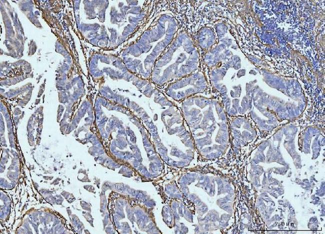 COL6A2 Antibody in Immunohistochemistry (Paraffin) (IHC (P))