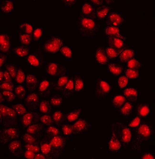 WAPL Antibody in Immunocytochemistry (ICC/IF)