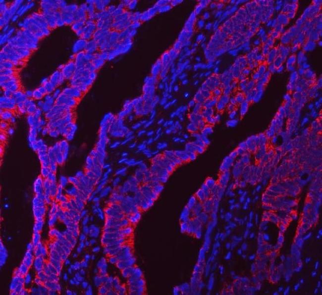 NDUFS5 Antibody in Immunohistochemistry (Paraffin) (IHC (P))