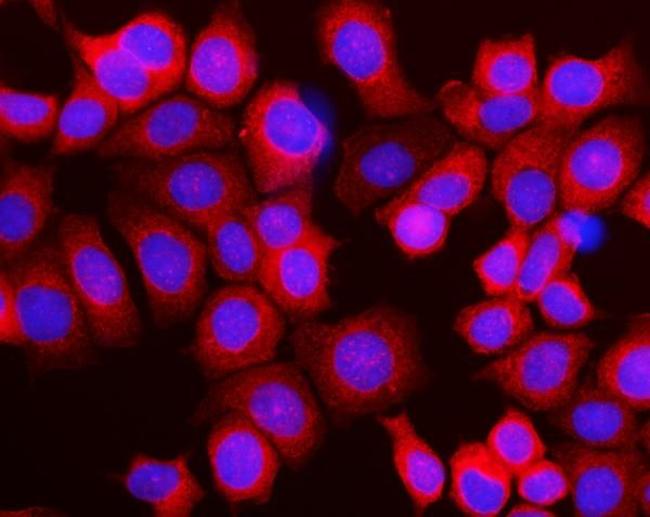 RPL10 Antibody in Immunocytochemistry (ICC/IF)