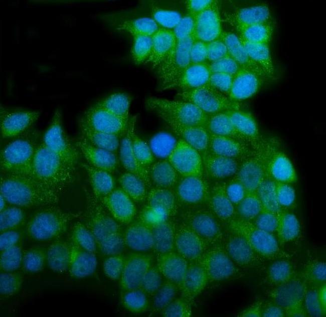 EHD3 Antibody in Immunocytochemistry (ICC/IF)