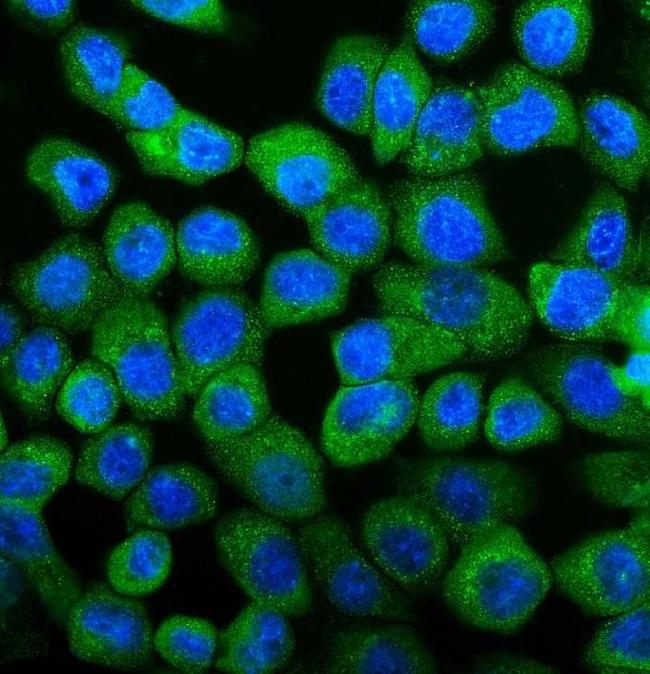 UBE2D1/2/3/4 Antibody in Immunocytochemistry (ICC/IF)