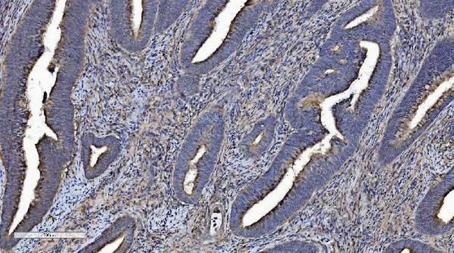 CMBL Antibody in Immunohistochemistry (Paraffin) (IHC (P))