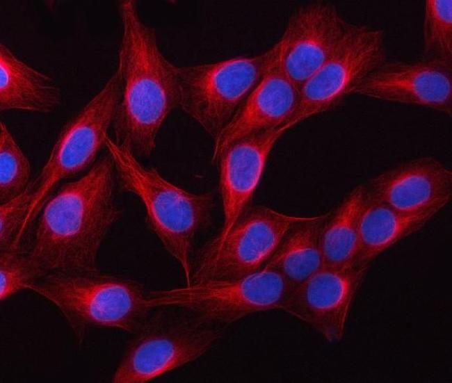 beta Tubulin Antibody in Immunocytochemistry (ICC/IF)