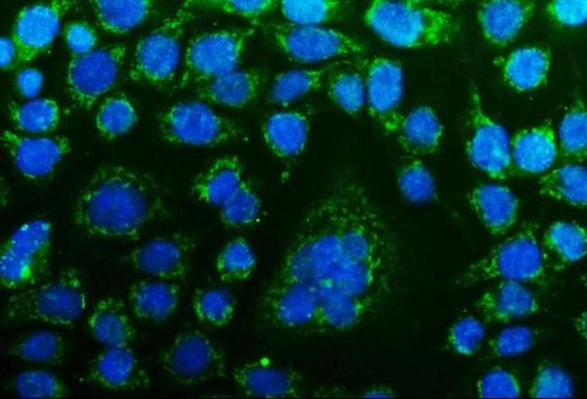 CHCHD10 Antibody in Immunocytochemistry (ICC/IF)