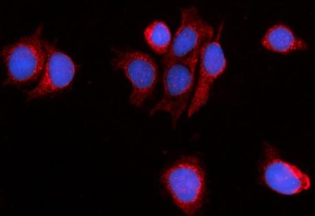 Myomegalin Antibody in Immunocytochemistry (ICC/IF)