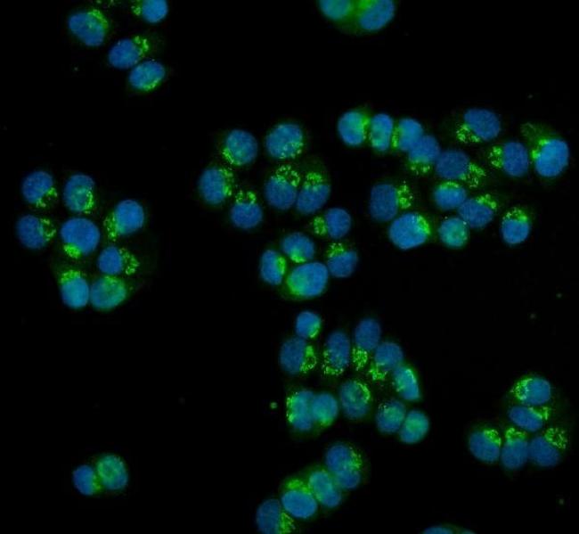 HOXC13 Antibody in Immunocytochemistry (ICC/IF)