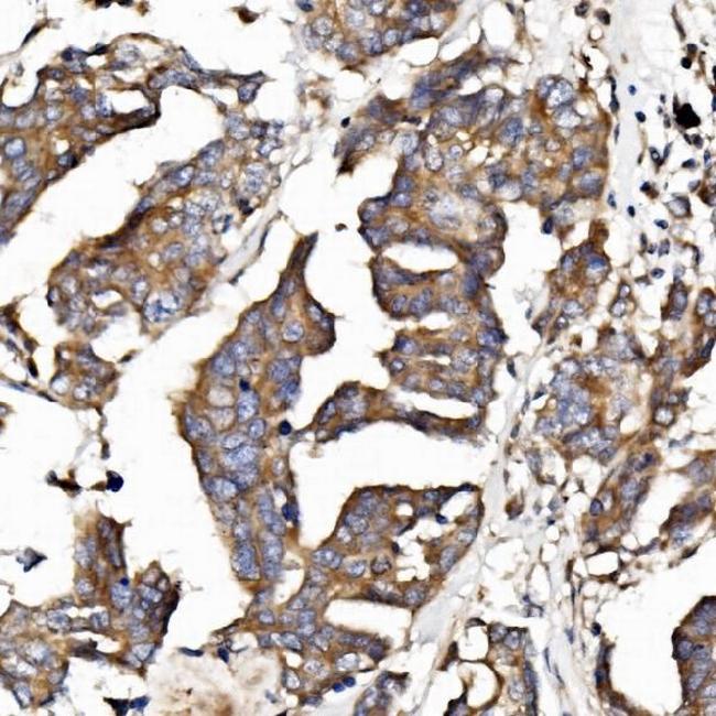 EPB41L5 Antibody in Immunohistochemistry (Paraffin) (IHC (P))