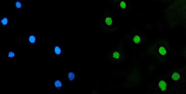 LSM5 Antibody in Immunocytochemistry (ICC/IF)