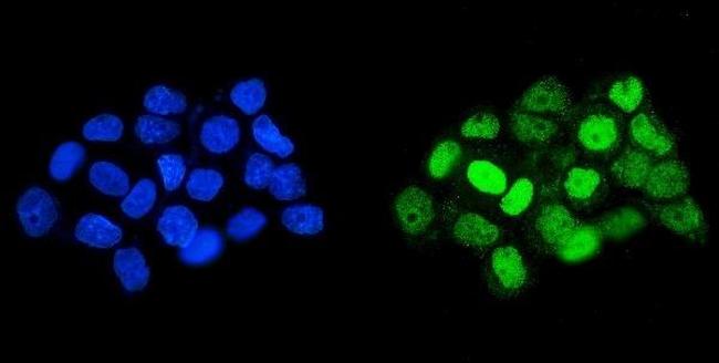 HOXD11 Antibody in Immunocytochemistry (ICC/IF)