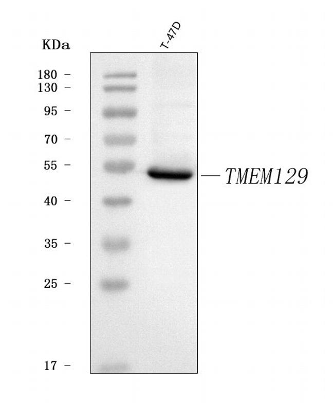 TMEM129 Antibody in Western Blot (WB)