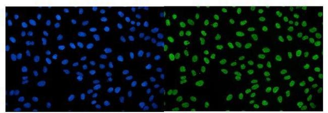 IGF2-AS Antibody in Immunocytochemistry (ICC/IF)