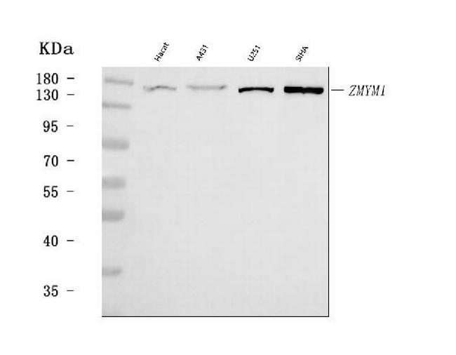 ZMYM1 Antibody in Western Blot (WB)