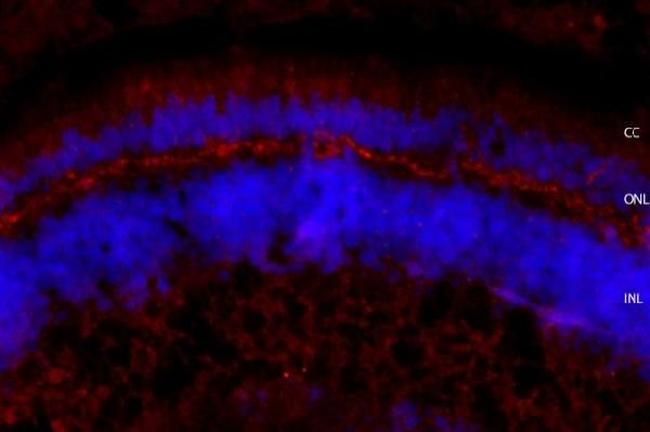 Usherin Antibody in Immunohistochemistry (Frozen) (IHC (F))