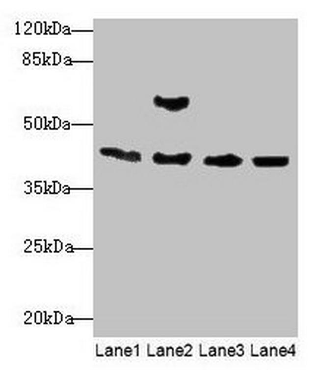 ACTA1 Antibody in Western Blot (WB)