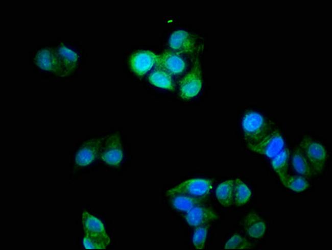 Cardiac Troponin I Antibody in Immunocytochemistry (ICC/IF)