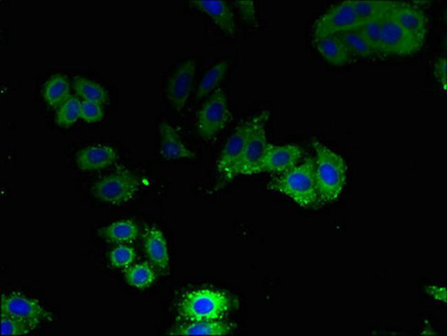 Aquaporin 1 Antibody in Immunocytochemistry (ICC/IF)