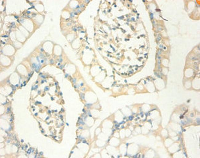 MT1X Antibody in Immunohistochemistry (Paraffin) (IHC (P))