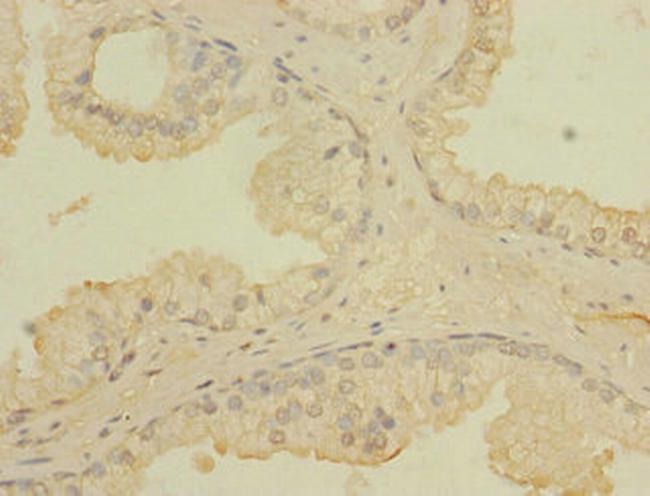 CCDC79 Antibody in Immunohistochemistry (Paraffin) (IHC (P))