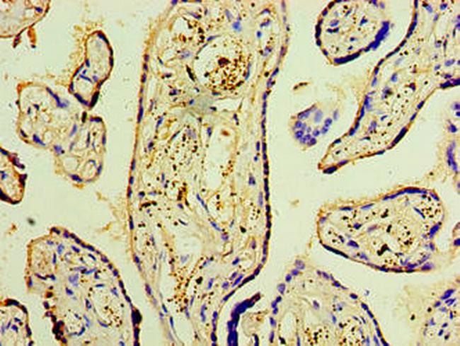 DNAH3 Antibody in Immunohistochemistry (Paraffin) (IHC (P))