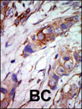 ERK5 Antibody in Immunohistochemistry (Paraffin) (IHC (P))