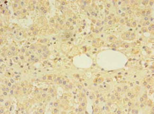 MTR Antibody in Immunohistochemistry (Paraffin) (IHC (P))