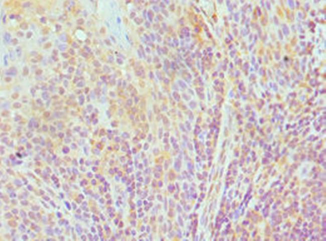 ELOA Antibody in Immunohistochemistry (Paraffin) (IHC (P))