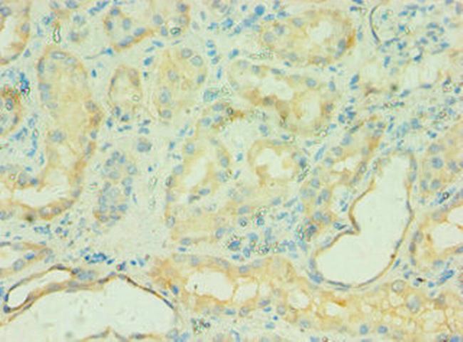 C4BPB Antibody in Immunohistochemistry (Paraffin) (IHC (P))