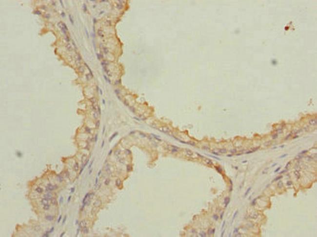 NMT2 Antibody in Immunohistochemistry (Paraffin) (IHC (P))