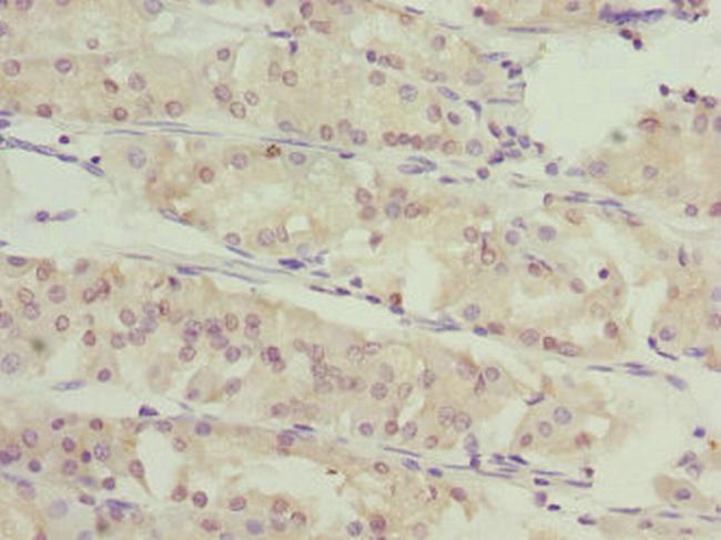 SLC46A1 Antibody in Immunohistochemistry (Paraffin) (IHC (P))