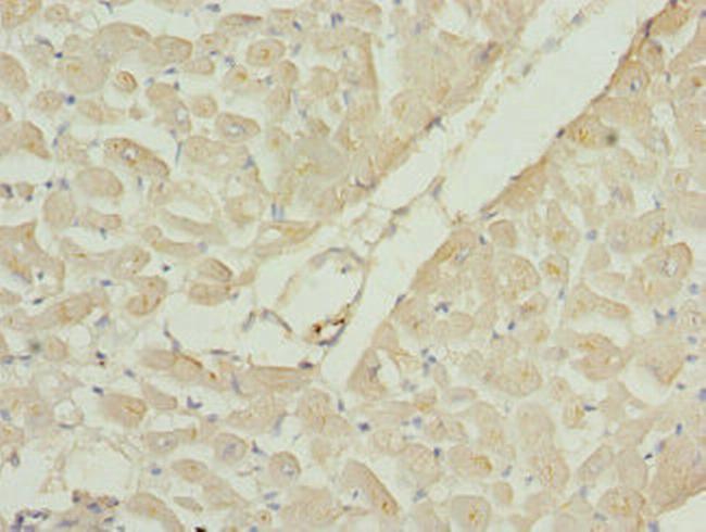 RAC3 Antibody in Immunohistochemistry (Paraffin) (IHC (P))