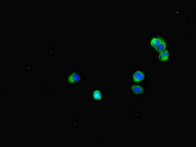 BUBR1 Antibody in Immunocytochemistry (ICC/IF)