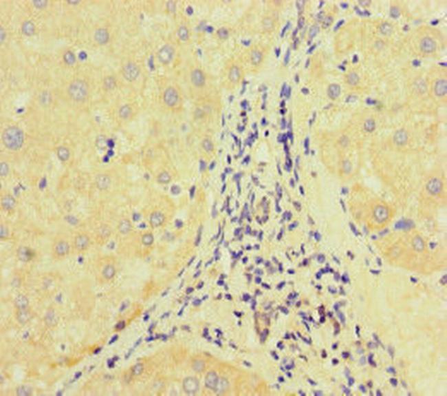 E2F1 Antibody in Immunohistochemistry (Paraffin) (IHC (P))