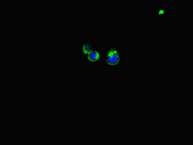 LATS1 Antibody in Immunocytochemistry (ICC/IF)