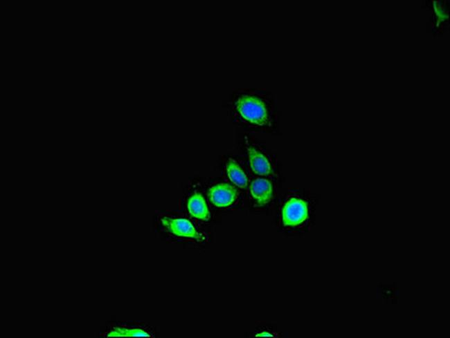 SBF2 Antibody in Immunocytochemistry (ICC/IF)