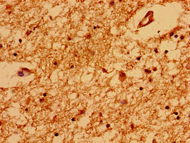 TRNP1 Antibody in Immunohistochemistry (Paraffin) (IHC (P))