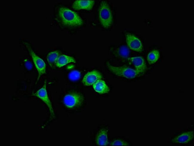 DR4 Antibody in Immunocytochemistry (ICC/IF)