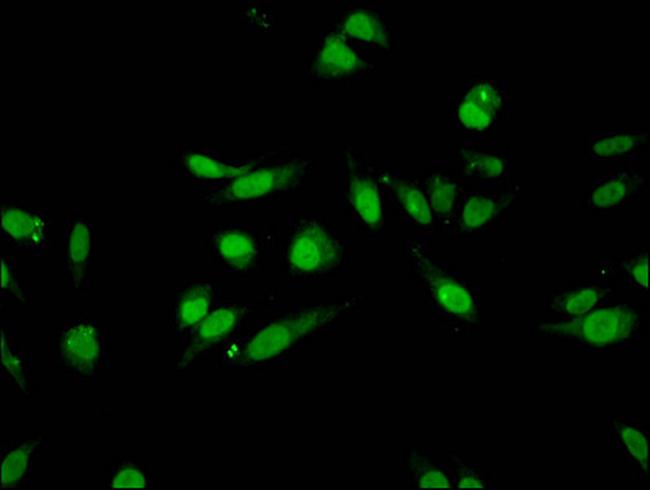 H3K27me1 Antibody in Immunocytochemistry (ICC/IF)