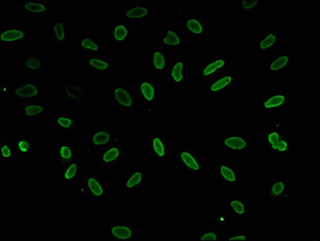 Acetyl-Histone H1.4 (Lys51) Antibody in Immunocytochemistry (ICC/IF)