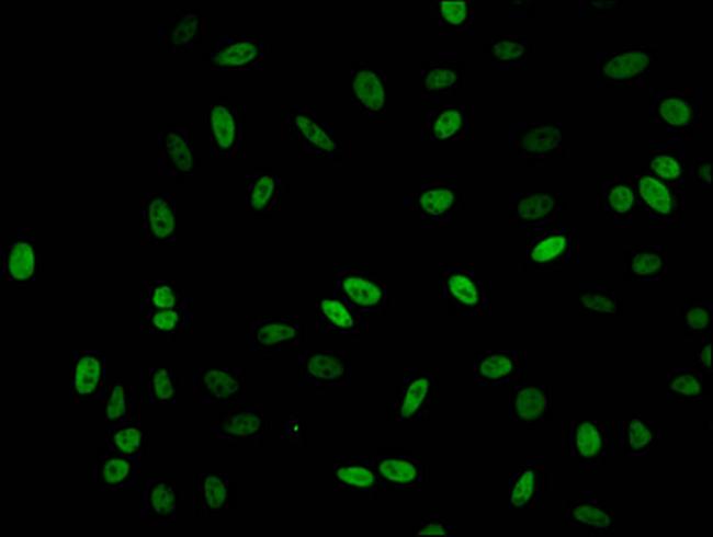 Acetyl-Histone H1.2 (Lys62) Antibody in Immunocytochemistry (ICC/IF)