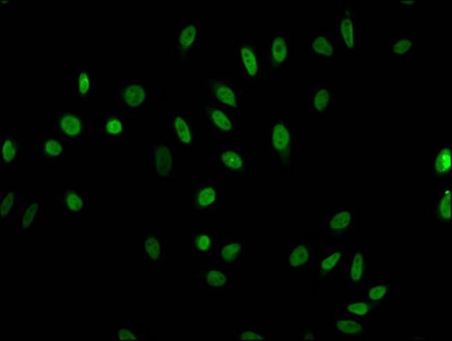 Acetyl-Histone H1.4 (Lys63) Antibody in Immunocytochemistry (ICC/IF)