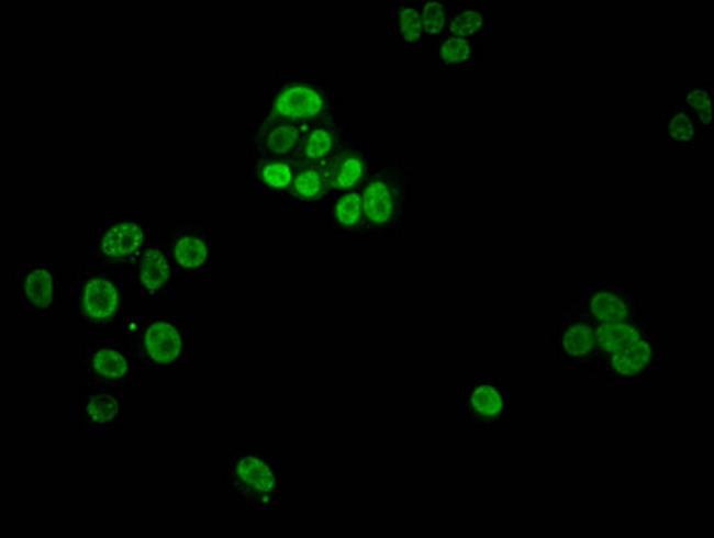 Phospho-Histone H1.4 (Thr3) Antibody in Immunocytochemistry (ICC/IF)