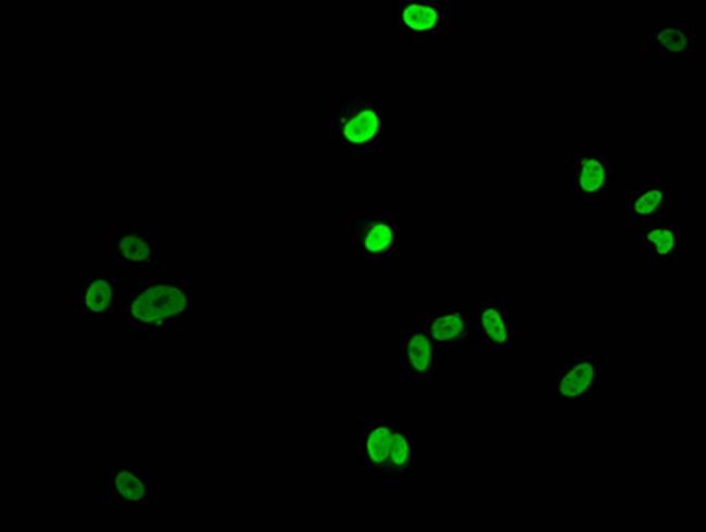 Acetyl-Histone H1.4 (Lys16) Antibody in Immunocytochemistry (ICC/IF)