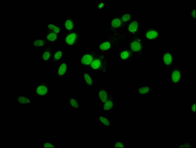 2-hydroxyisobutyryl-Histone H1.2 (Lys63) Antibody in Immunocytochemistry (ICC/IF)